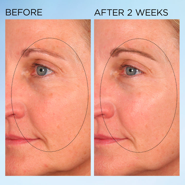 Visible Brightening Clearly Radiant Spot Correcting Capsules