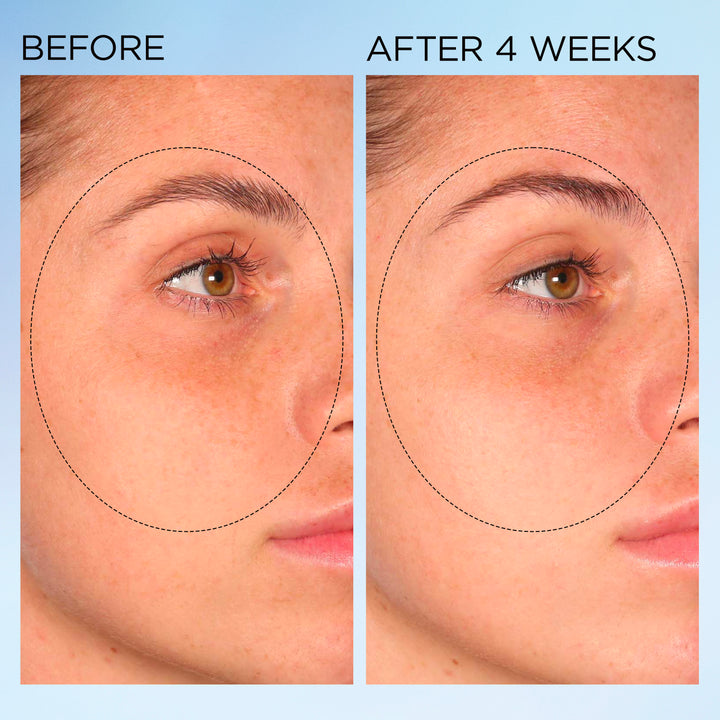 Visible Brightening Clearly Radiant Spot Correcting Capsules